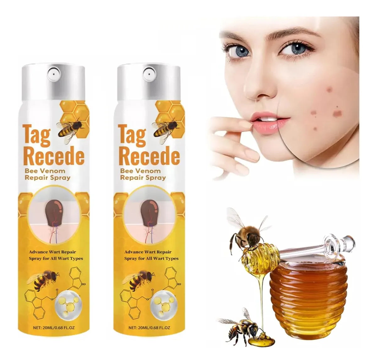 TAG RECEDE Elimina verrugas